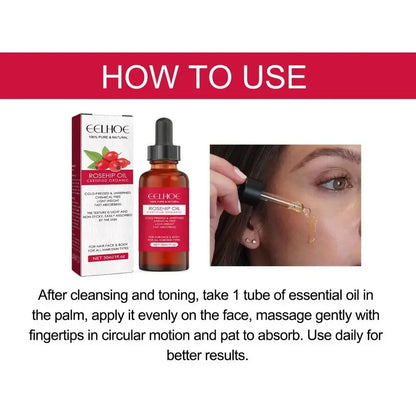 Cold-Pressed Rosehip Facial Oil – 30ml