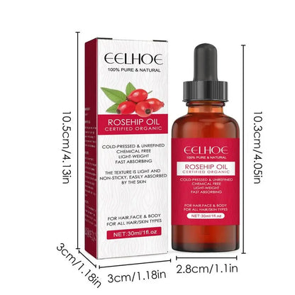 Cold-Pressed Rosehip Facial Oil – 30ml